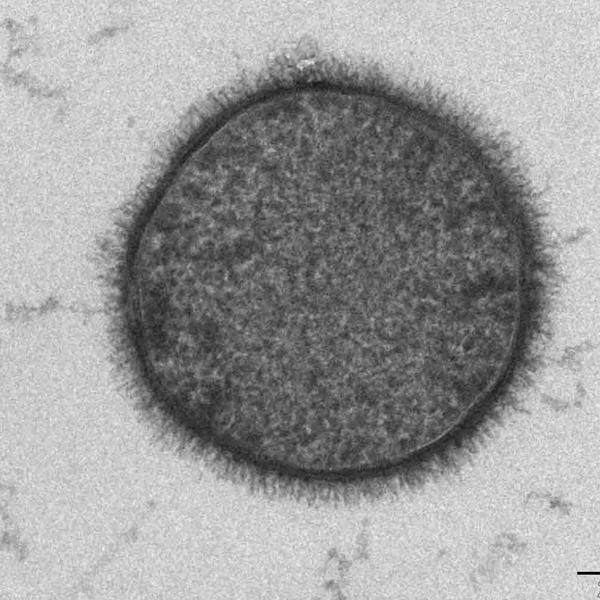 Mass Multiplication Of Bacillus Subtilis